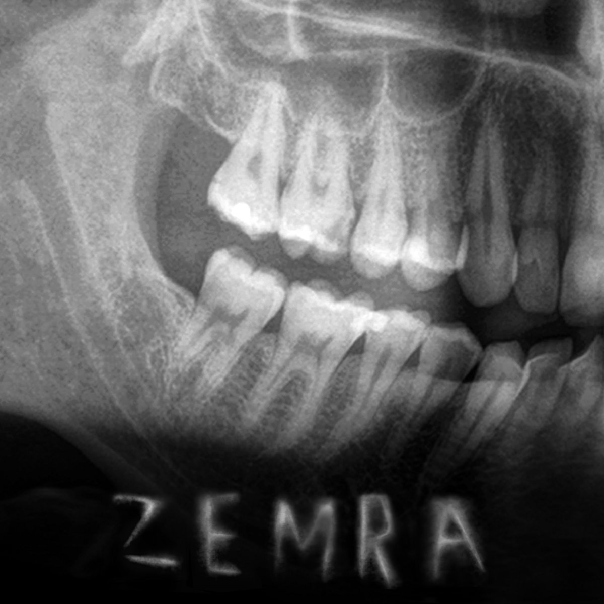 Zemra
